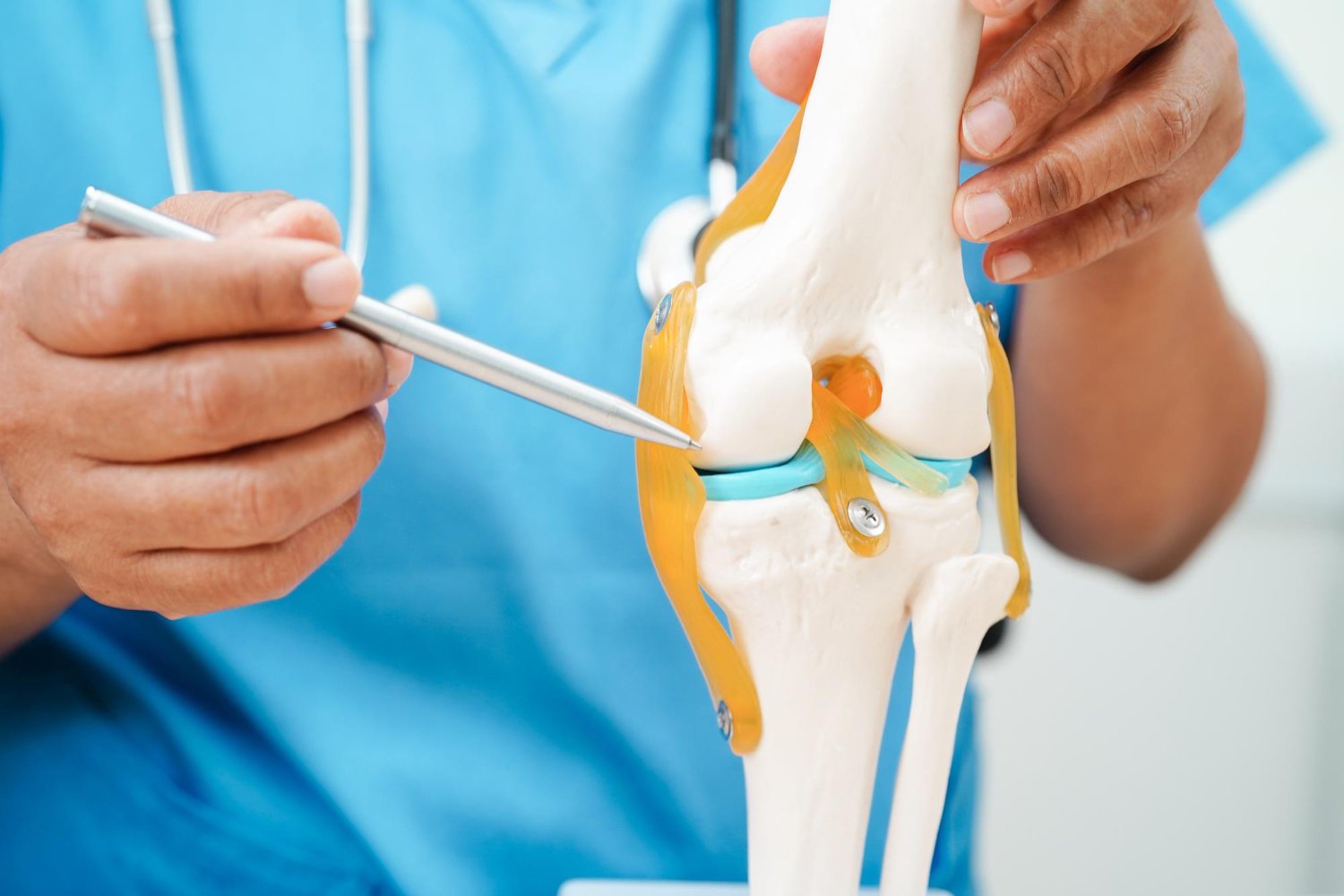 Especialista examinando un modelo de articulación de rodilla
